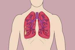 查出玻璃結節病灶,意味著得肺癌了?懷疑得肺癌,該做什麼檢查?