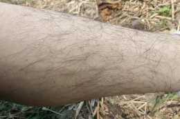 男性腿毛稀少預示不健康嗎?腿毛和哪些因素有關?男性請看