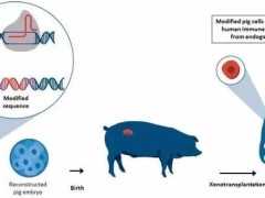 豬腎成功植入人體 但器官移植新時代還遠未到來